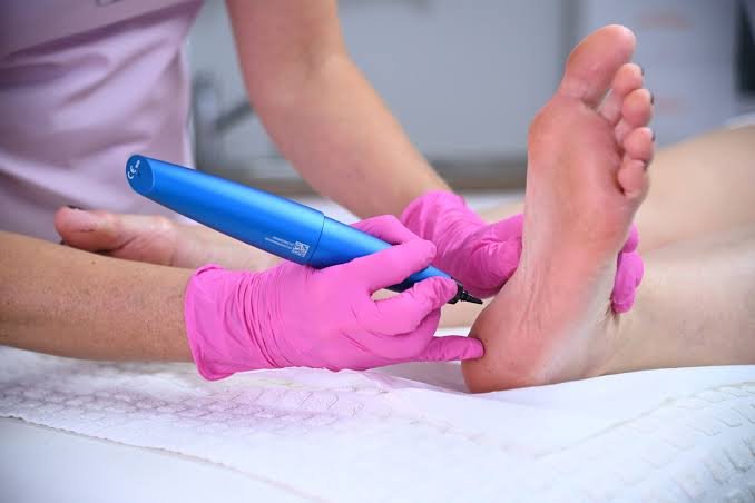 Clinician using a treatment pen on the sole of a foot